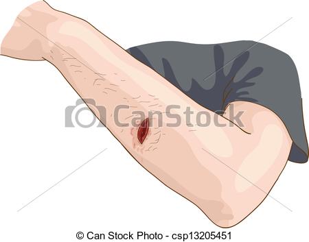 Wound Illustrations and Clip Art. 4,760 Wound royalty free.