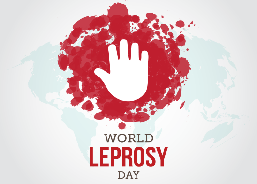 World Leprosy Day.