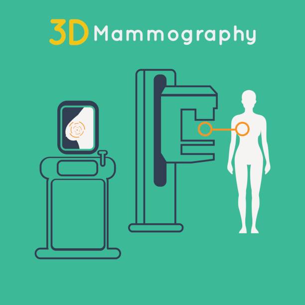 Best Mammogram Illustrations, Royalty.