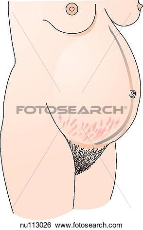 Stock Illustration of Anterolateral view of a pregnant woman.