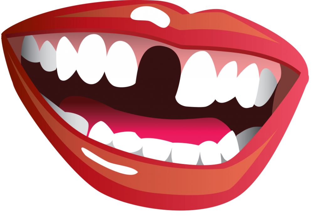 open mouth smile clipart 20 free Cliparts | Download images on