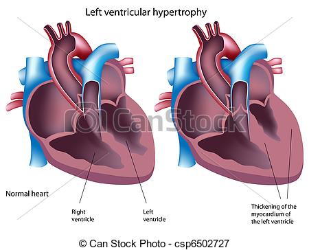 Pacemakers Illustrations and Clipart. 237 Pacemakers royalty free.