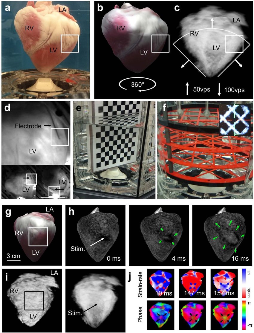 3D Imaging of electromechanical activity in the heart using.