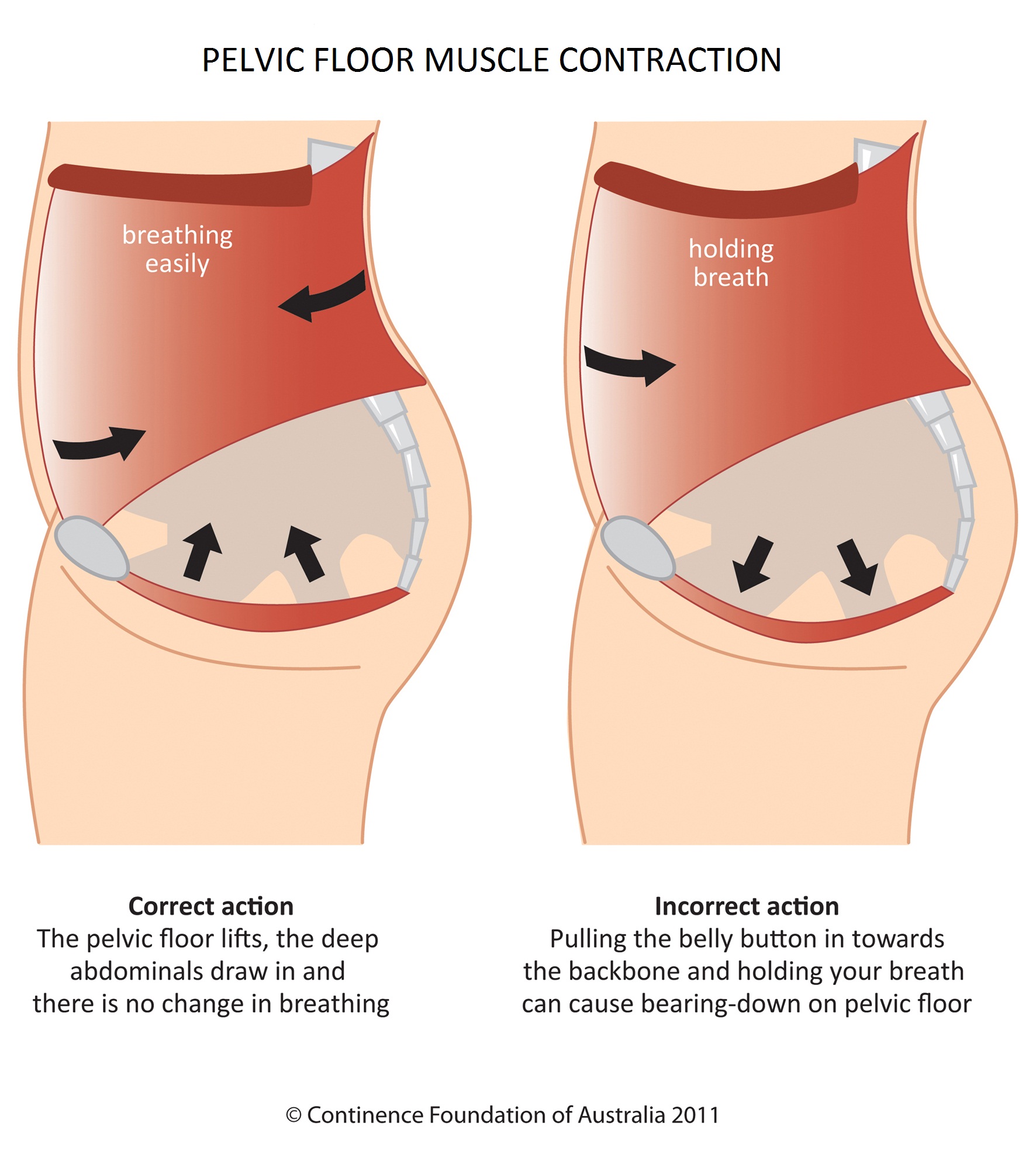 pelvic-floor-clipart-20-free-cliparts-download-images-on-clipground-2024