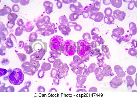 Stock Photo of White blood cells of a human, photomicrograph.