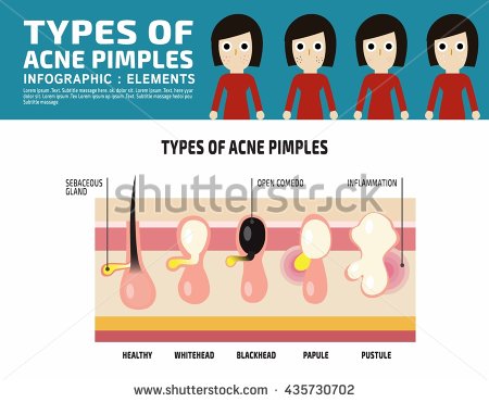 Pustules clipart 20 free Cliparts | Download images on Clipground 2024