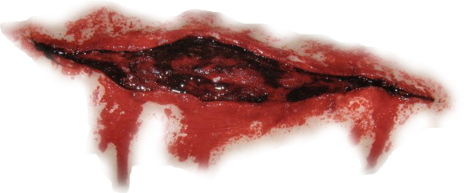 Scar Wound PNG Transparent Scar Wound.PNG Images..