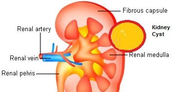 Kidney Fibrosis Treatment Market Research Report Upto 2022.