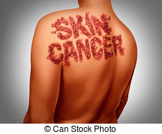 Skin cancer Illustrations and Clip Art. 1,488 Skin cancer royalty.