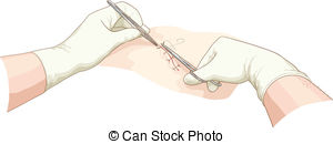 Suture Illustrations and Clipart. 707 Suture royalty free.