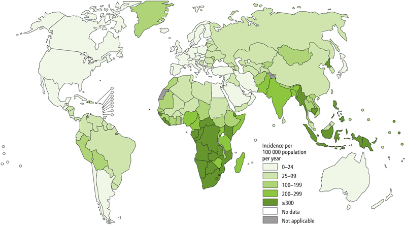 TB statistics.