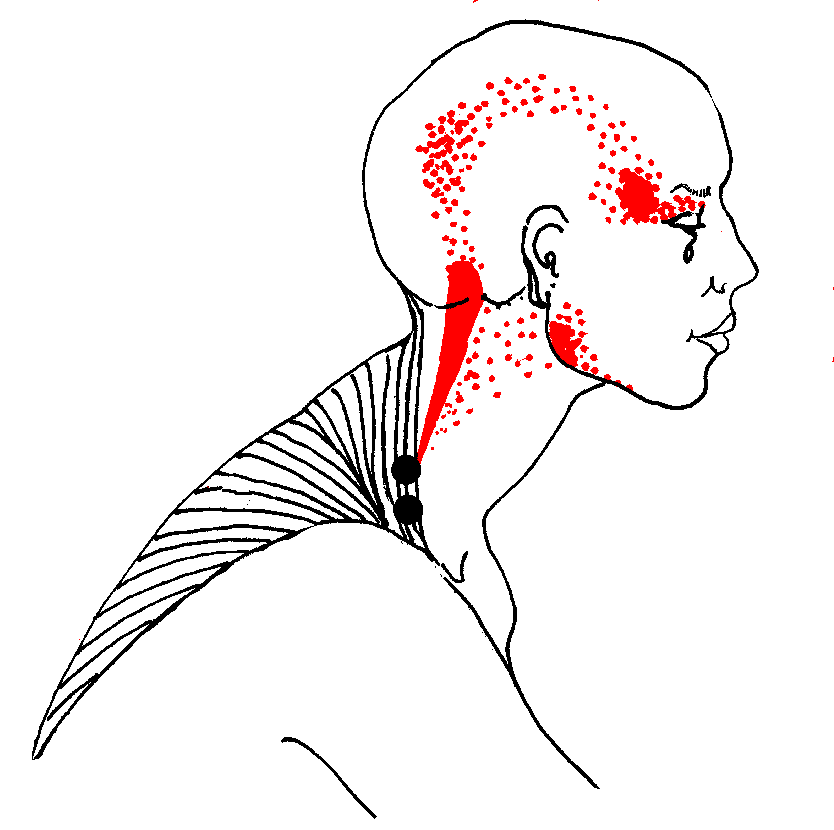 Free Headache Pictures, Download Free Clip Art, Free Clip.