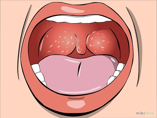 https://clipground.com/images/tonsils-clipart-3.jpg