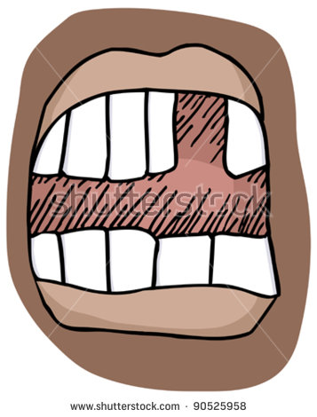 Tooth gap clipart.