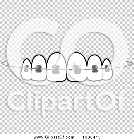 Tooth with Braces Clip Art.