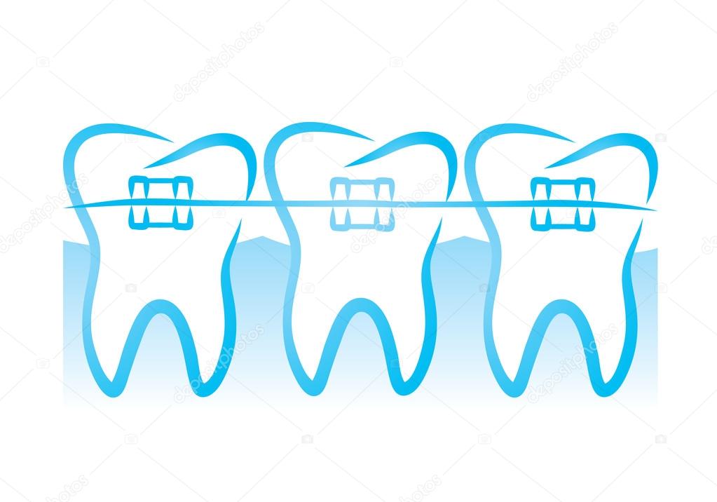 Download tooth with braces clipart 20 free Cliparts | Download ...
