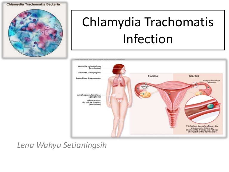 Хламидия trachomatis. ДНК хламидии трахоматис. Урогенитальный хламидиоз у женщин.