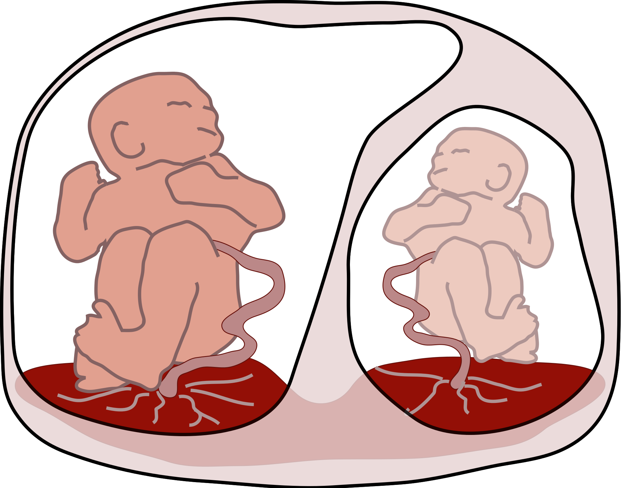 Twins clipart identical, Twins identical Transparent FREE.