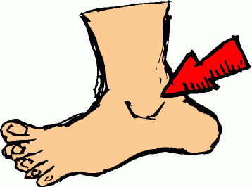 Free Ankle Injury Cliparts, Download Free Clip Art, Free.