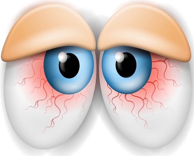 very tired eyes clipart 20 free Cliparts | Download images on