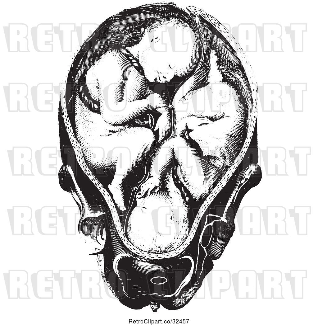 Vector Clip Art of Retro Twins in a Womb by Picsburg.