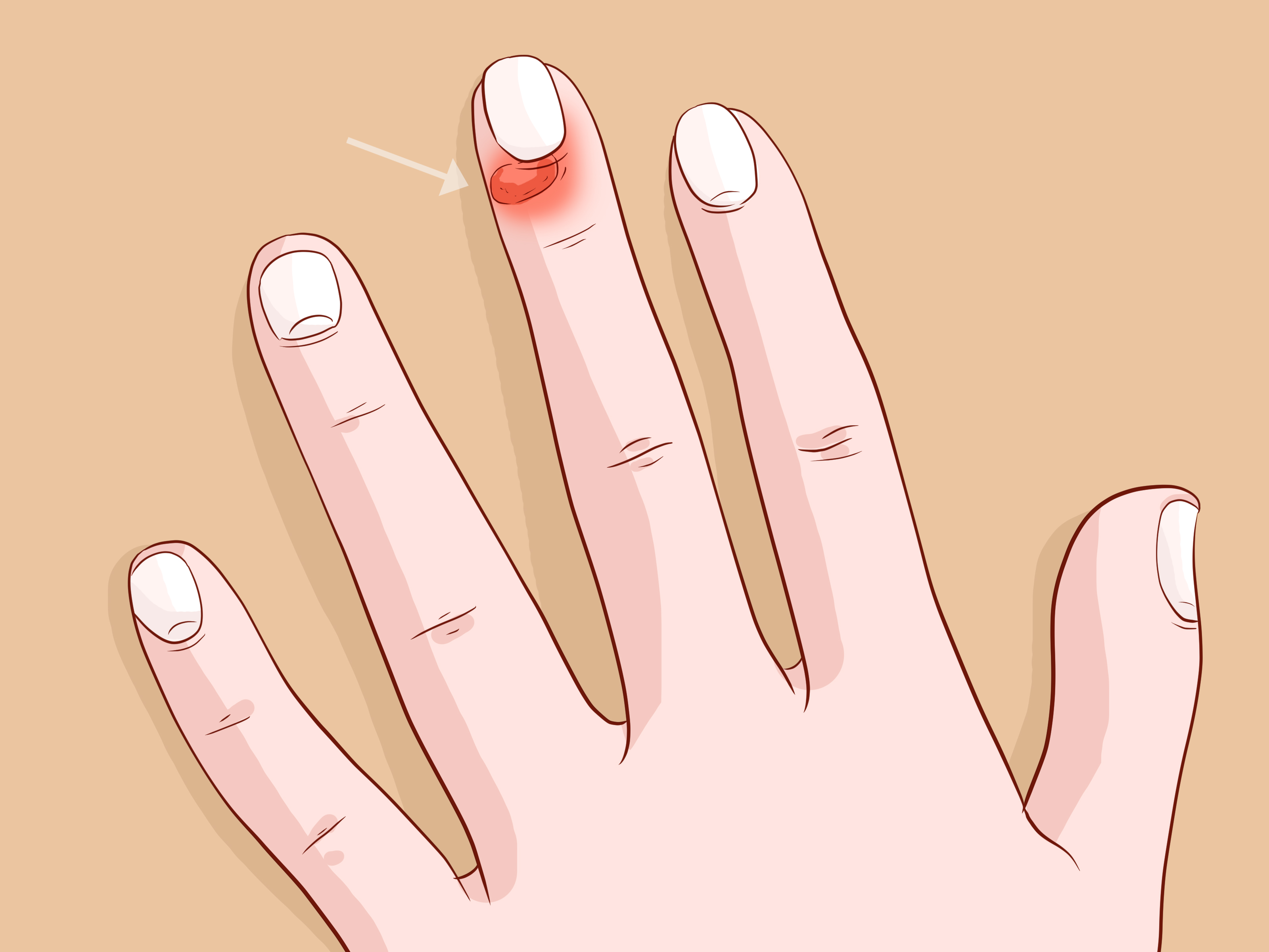 How to Care for Your Nails: 10 Steps (with Pictures).
