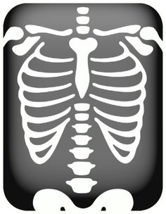 Chest X Ray Clipart.